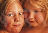 Paulinchen – Initiative für brandverletzte Kinder e.V.